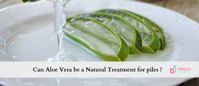 Can-Aloe-Vera-be-a-Natural-Treatment-for-piles